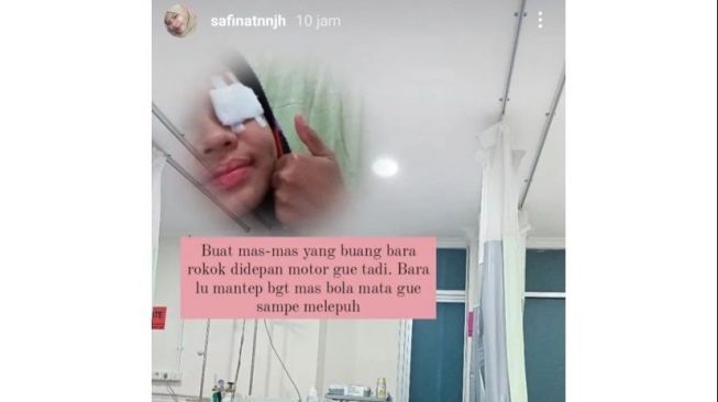 Bikin Ulah Lagi, Mata Wanita Ini sampai Melepuh Akibat Bara Rokok Pemotor