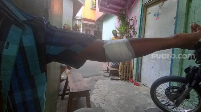 Jaeni alias Otoy (40), korban penyerangan pria ODGJ, memperlihatkan kondisi tangannya usai disayat pelaku karena tak terima ditegur usai robek umbul-umbul di Kelurahan Pisangan Baru, Kecamatan Matraman, Jakarta Timur, Senin (3/1/2022). [Suara.com/Yosea Arga Pramudita]