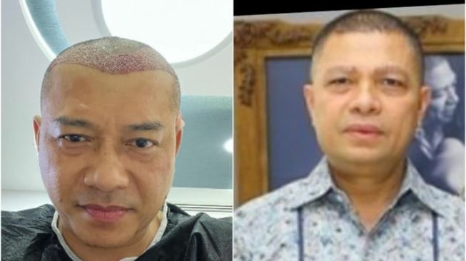 Penampilan Baru Anang Hermansyah Mirip Raul Lemos Bikin Netizen Merinding