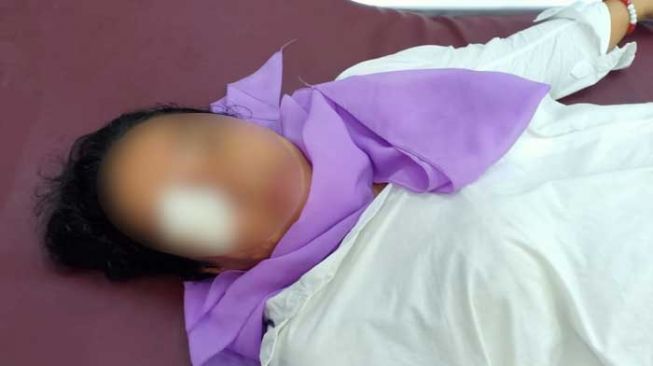 Sadis! Suami Siram Istri dengan Air Keras di Asahan