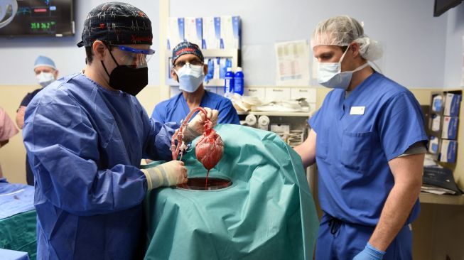 Dr Muhammad Mohiuddin memimpin operasi cangkok jantung babi pada seorang pasien di Amerika Serikat pada 7 Januari 2022 lalu. [AFP/University of Maryland School of Medicine]