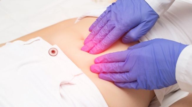 Tumor Ovarium Jinak dan Ganas, Apa Sama dengan Kanker?