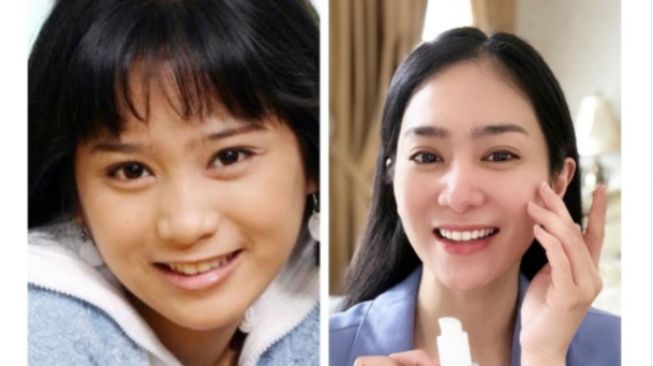 Mau Nangis Tengok Foto Jadul, Intip 7 Metamorfosa Bunga Zainal yang Kini Sudah Glowing