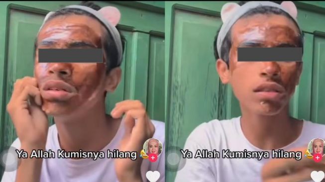 Video Lelaki Pakai Masker Peel Off Viral, Kasihan Banget Kumis Kiri Kanannya Habis Tertarik