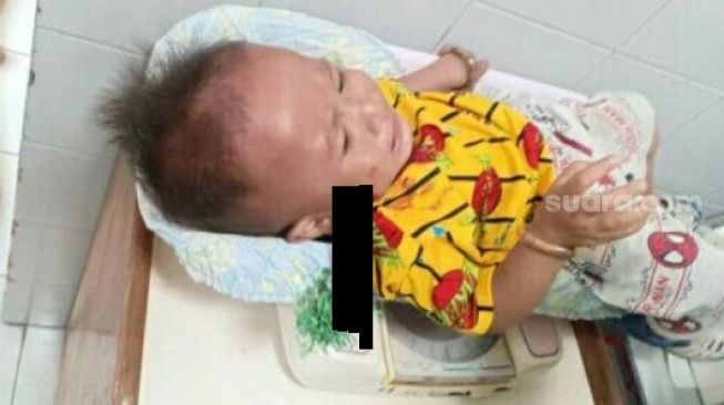 Bayi di Kota Makassar Kena Busur di Bagian Pipi, Pelaku Masih Dikejar