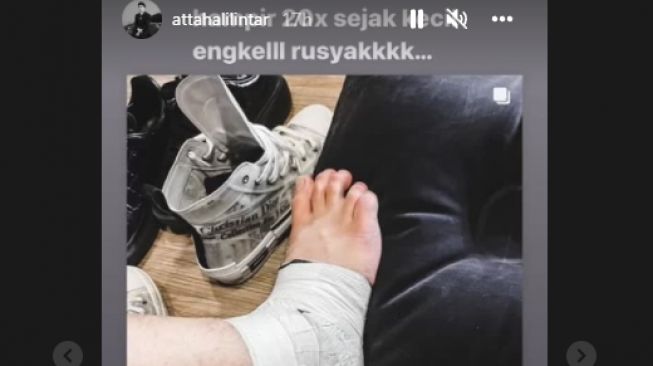 Atta Halilintar cedera di bagian kaki [Instagram/@attahalilintar]