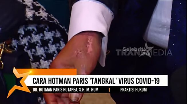 Hotman Paris (YouTube/TRANS7 Lifestyle)