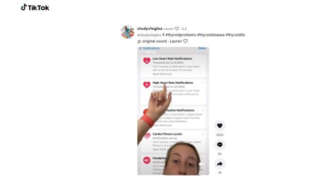 Apple Watch deteksi teroid lebih awal dari diagnosis. [TikTok]