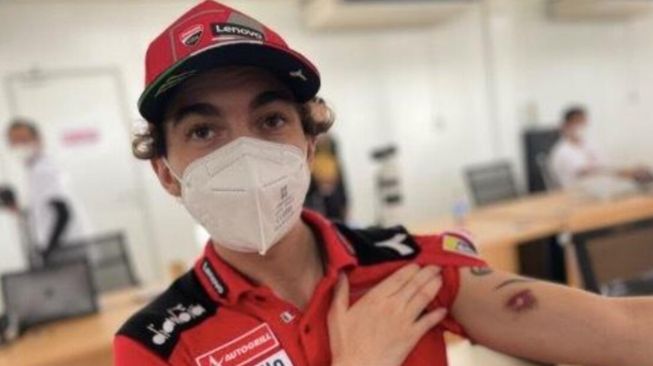 Pebalap Ducati MotoGP, Francesco Bagnaia memperlihatkan luka akibat terkena serpihan batu di Sirkuit Mandalika. [Twitter/@denkmit]