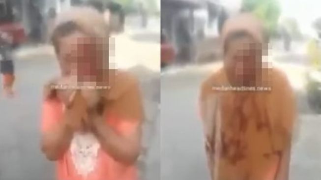 Pria Tega Lempar Kepala Ibunya Pakai Ponsel hingga Bocor, Videonya Viral Bikin Nyesek