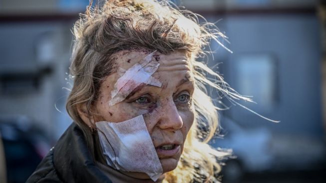 Seorang wanita Ukraina tampak berdiri di depan sebuah rumah sakit di Kota Chuguiv di timur Ukraina, wajahnya penuh luka dengan sorot muka penuh kesedihan. (Foto: AFP)