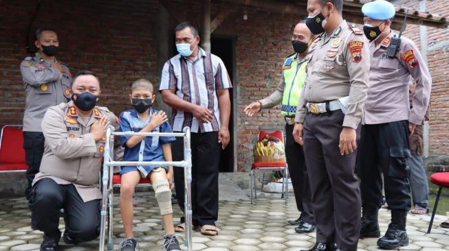 Diamputasi Akibat Kanker Tulang, Bocah Kiki Kembali Berjalan Berkat Kaki Palsu Pemberian Kapolres Demak