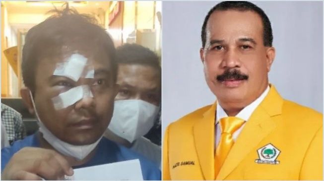 Haris Pertama Duga Pengeroyokan Dirinya Terkait Persoalan Internal Golkar