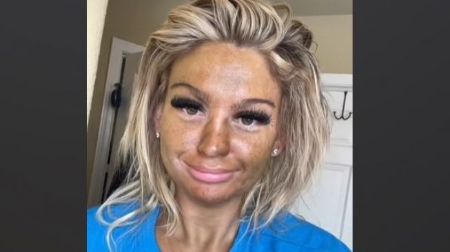 Ingin Punya Kulit Wajah Tanning, Wanita Ini Malah Apes Penampilannya Jadi Begini