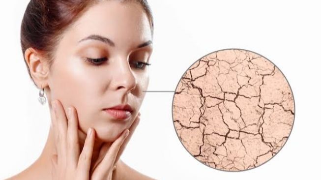 5 Tips Memperbaiki Skin Barrier yang Rusak, Agar Kulit Kembali Normal