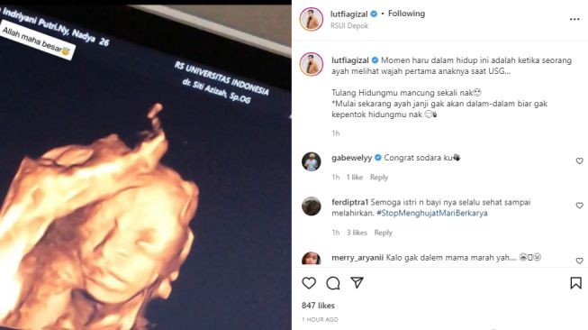 Foto USG calon buah hati Lutfi Agizal dan Nadya Indry (instagram.com)