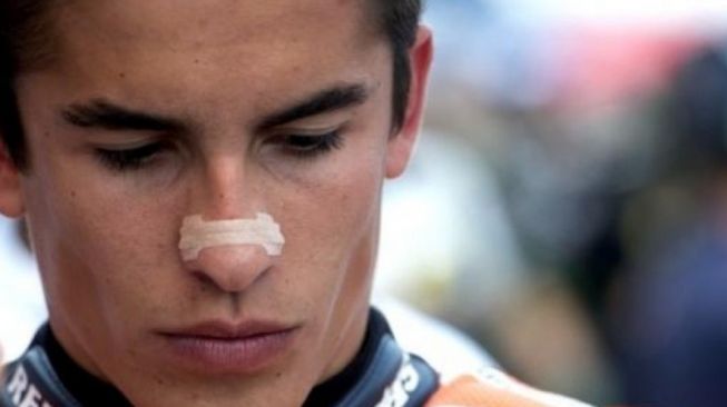 Marc Marquez menggunakan plester pada hidung sebelum balap dimulai (Instagram)