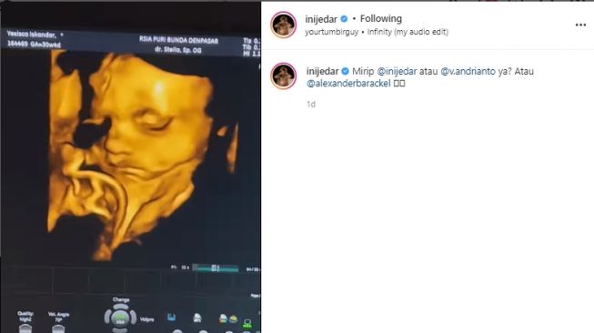 Jessica Iskandar pamer USG anak kedua (instagram.com)