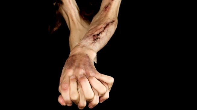 Ini 3 Tingkatan Self-Harm yang Harus Kamu Pahami!
