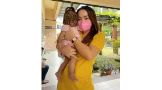 Viral Bayi Istimewa Miliki Bulu Lebat di Wajah, Warganet Beri Dukungan