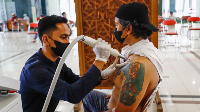 Petugas menghapus tato peserta saat program hapus tato di Masjid Assahara, Kembangan, Jakarta Barat, Rabu (13/4/2022). [Suara.com/Alfian Winanto]