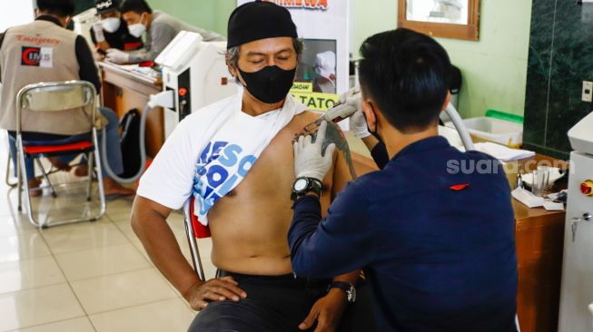 Petugas menghapus tato peserta saat program hapus tato di Masjid Assahara, Kembangan, Jakarta Barat, Rabu (13/4/2022). [Suara.com/Alfian Winanto]