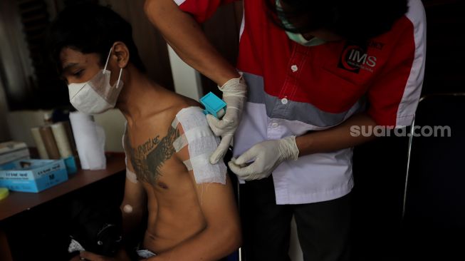 [ILUSTRASI] Petugas memasangkan perban kepada seorang peserta usai mengikuti kegiatan hapus tato gratis di Kantor Sekretariat DPP Forum Ulama Habaib (Fuhab), Jakarta, Selasa (19/4/2022). [Suara.com/Angga Budhiyanto]