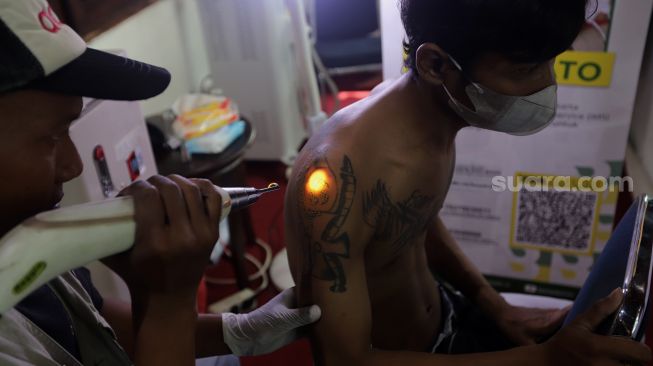 Petugas menghapus tinta tato dengan menggunakan laser saat kegiatan hapus tato gratis di Kantor Sekretariat DPP Forum Ulama Habaib (Fuhab), Jakarta, Selasa (19/4/2022). [Suara.com/Angga Budhiyanto]