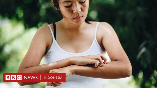Bagaimana Perubahan Iklim dan Vaksin Mempengaruhi Perang Melawan Malaria