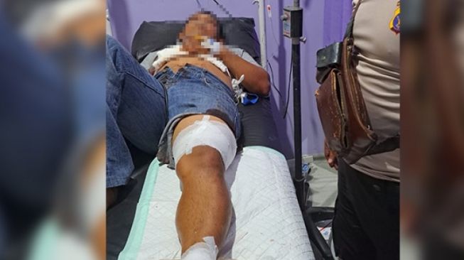 Duel Berdarah 2 Pria di Muara Badak, Kepala Dipukul Balok sampai Perut Disabet Taji