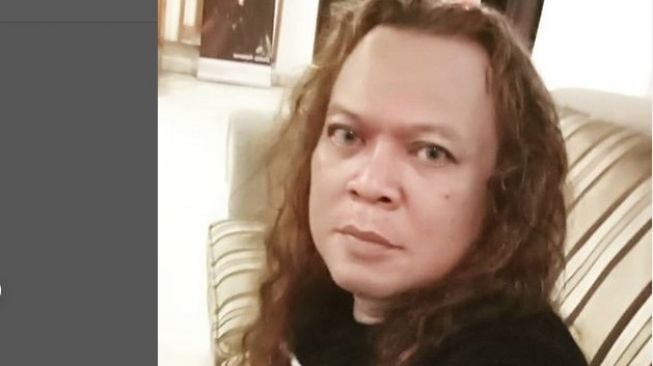 Doddy Katamsi Alami Pembengkakan dan Klep Jantung Bocor