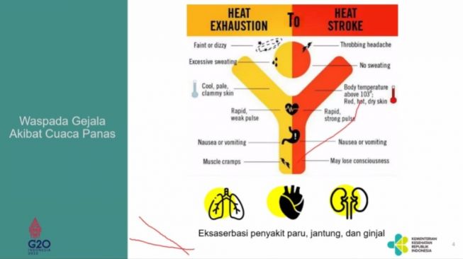 Tanda-Tanda Heat Stroke, Jemaah Haji Wajib Waspadai Gejala Ini Ketika Cuaca Panas