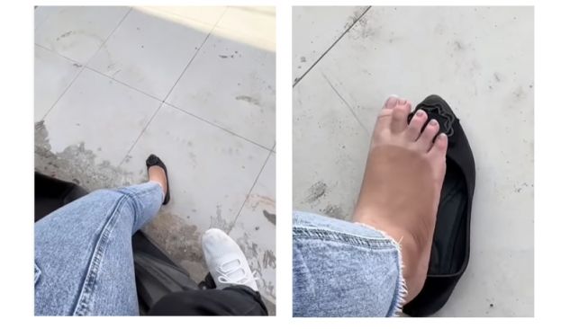 Efek samping pemotor yang menggunakan flat shoes saat berkendara (Instagram)
