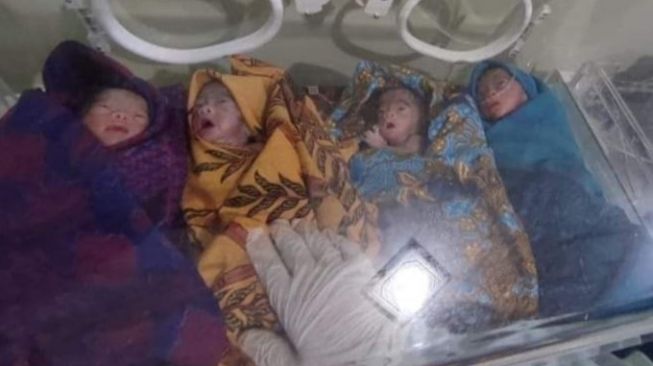 Dokter Berjuang Selamatkan Bayi Kembar Empat di Kolaka Timur