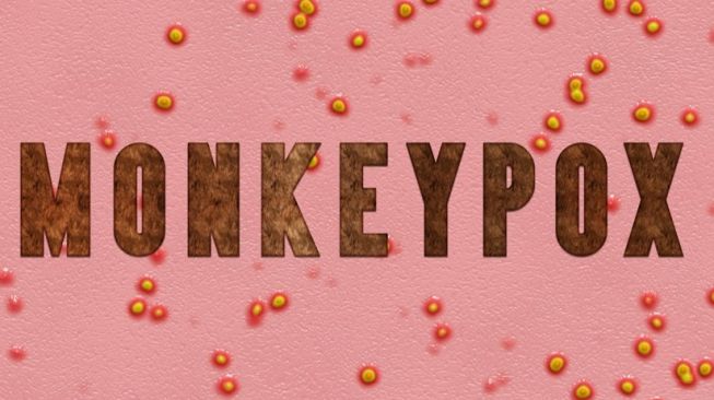 Menkes: Monkeypox Belum Masuk Kriteria Pandemi