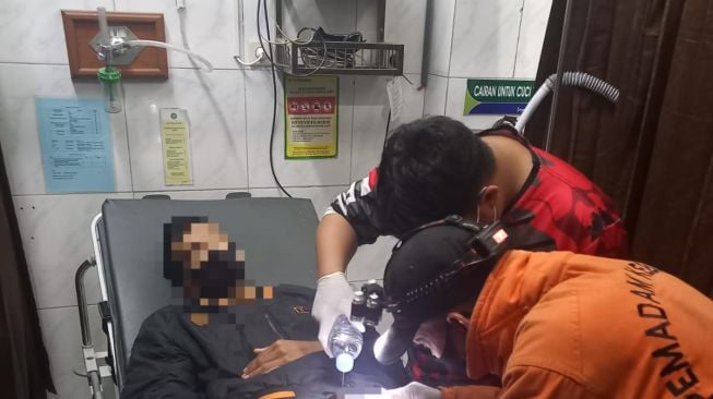 Sebuah Cincin Terjebak di Pangkal Kemaluan Pria Asal Pundong Selama 2 Hari, Endingnya Dipotong Tim Damkar Bantul