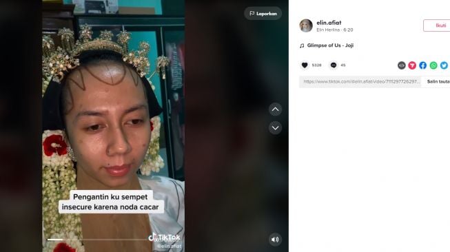 Riasan yang mampu menutupi bekas cacar (tiktok/elin.afiat)