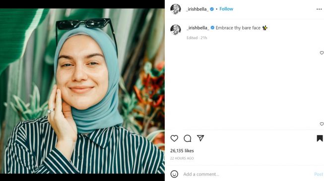Foto: Irish Bella Bagikan Potret Selfie Tanpa Make Up, Warganet: Kalau Natural Bulenya Kelihatan (instagram/_irishbella_)