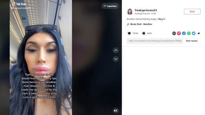 Filler bibir berulang kali (tiktok/freaky.princesss33)