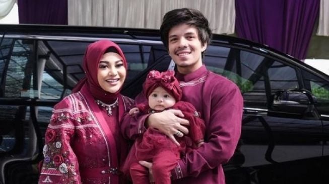 Anak Aurel Hermansyah Idap Asma Kulit, Begini Cara Mengobatinya!