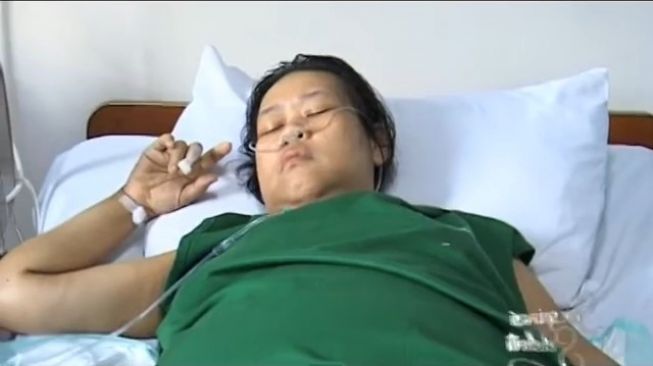 Kenali Gejala Diabetes, Penyakit yang Merenggut Nyawa Komedian Rini S Bon Bon