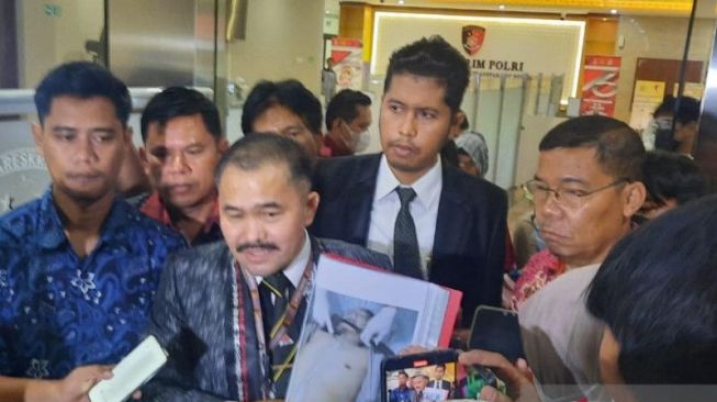 Pengacara Kamaruddin Simanjuntak memperlihatkan barang bukti foto kondisi luka di tubuh Brigadir J usai membuat laporan di Bareskrim Polri, Jakarta, Senin (18/7/2022). ANTARA/Laily Rahmawaty.