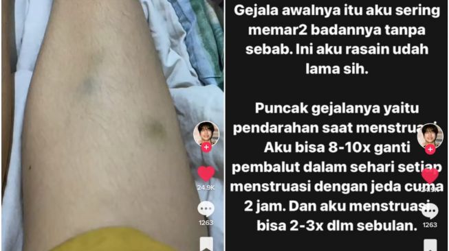 Viral penderita kanker darah (TikTok/@akusukajamaldanbakwan)