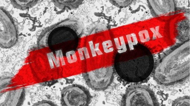Monkey Pox atau Cacar Monyet (Pixabay)