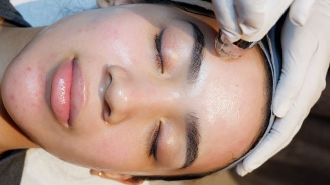 Yuk Milenials Merapat, Ada Inovasi Perawatan Kulit Glowing Sekali Treatment dengan Harga Terjangkau Lho!