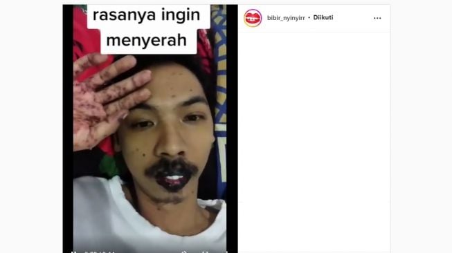 Pria terkena flu Singapura (Instagram/@bibir_nyinyirr)