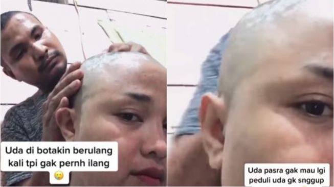 Wanita Ini Botaki Rambut, Perilaku Manis Sang Suami Bikin Adem Istrinya