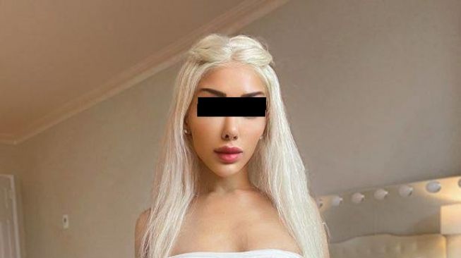 Bosan dengan Wajah Barbie Hasil Filler, Wanita Ini Ingin Kembali Memiliki Muka Alaminya