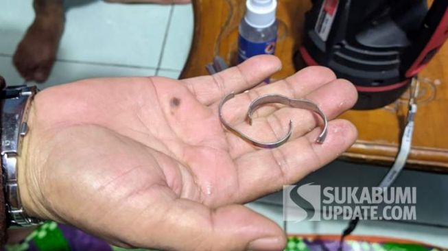 Rumah Sakit Angkat Tangan, Petugas Damkar Gunakan Alat Khusus untuk Lepaskan Cincin dari Mr P Seorang Pria di Sukabumi