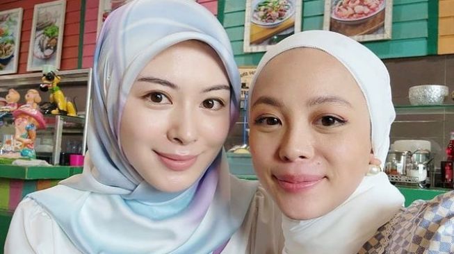 Potret Ayana Moon Kembali Tampil Syari (instagram/@xolovelyayana)